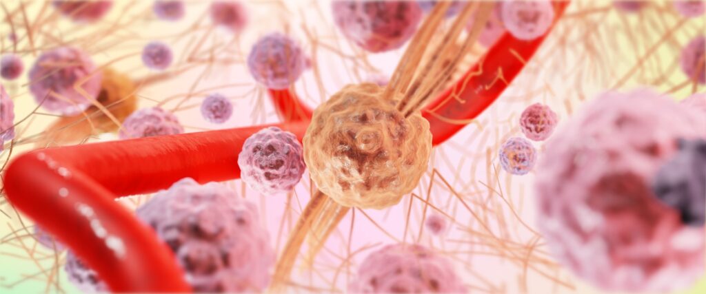 l importanza del sistema linfatico nell infiammazione