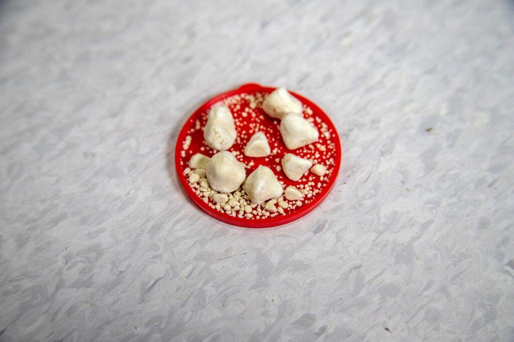 microrganismi intestinali e calcoli renali