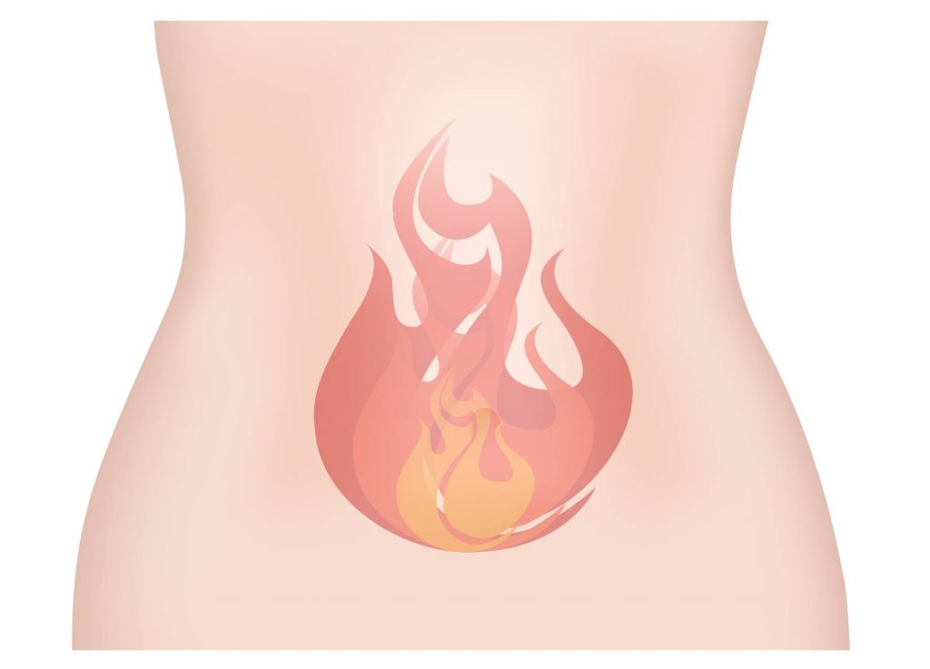 reflusso gastroesofageo